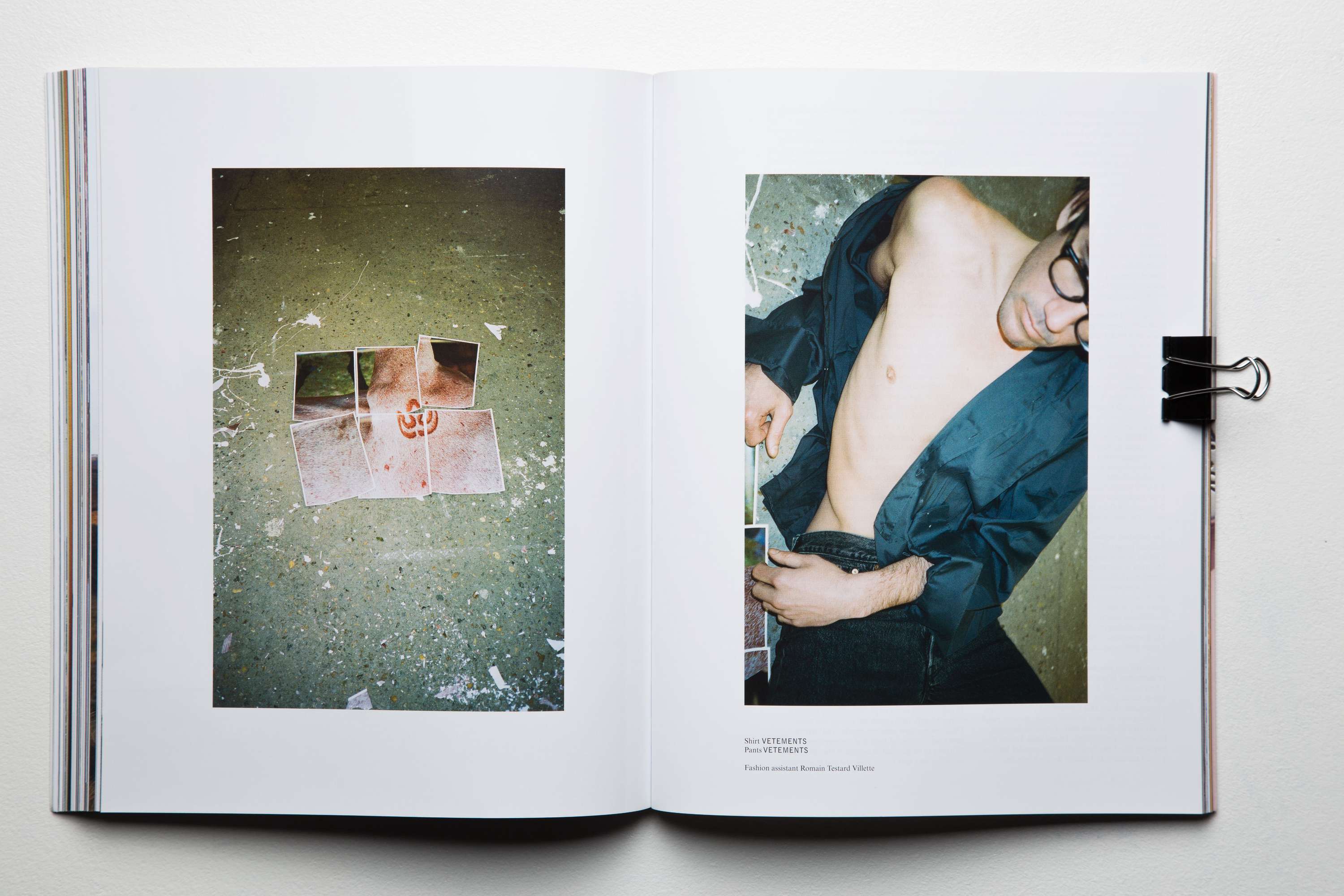 C.a.p. 74024 - A matter of skin by Amelie Sophia Rehm