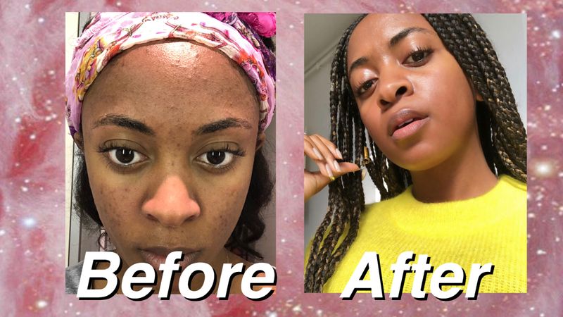 YouTube: Skincare Routine for acne prone sensitive skin by Dani Nicholls