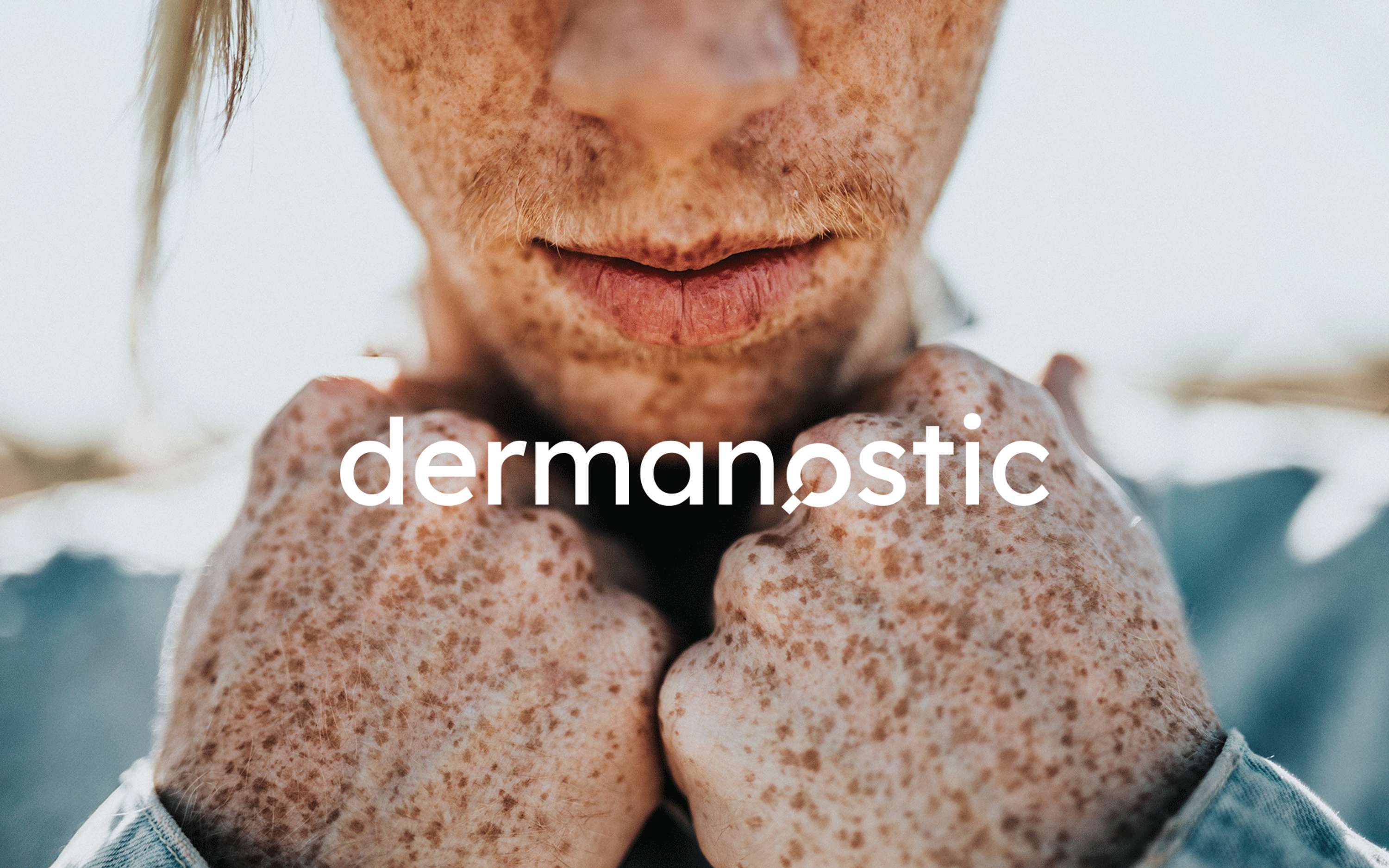 dermanostic by Corinna Hingelbaum