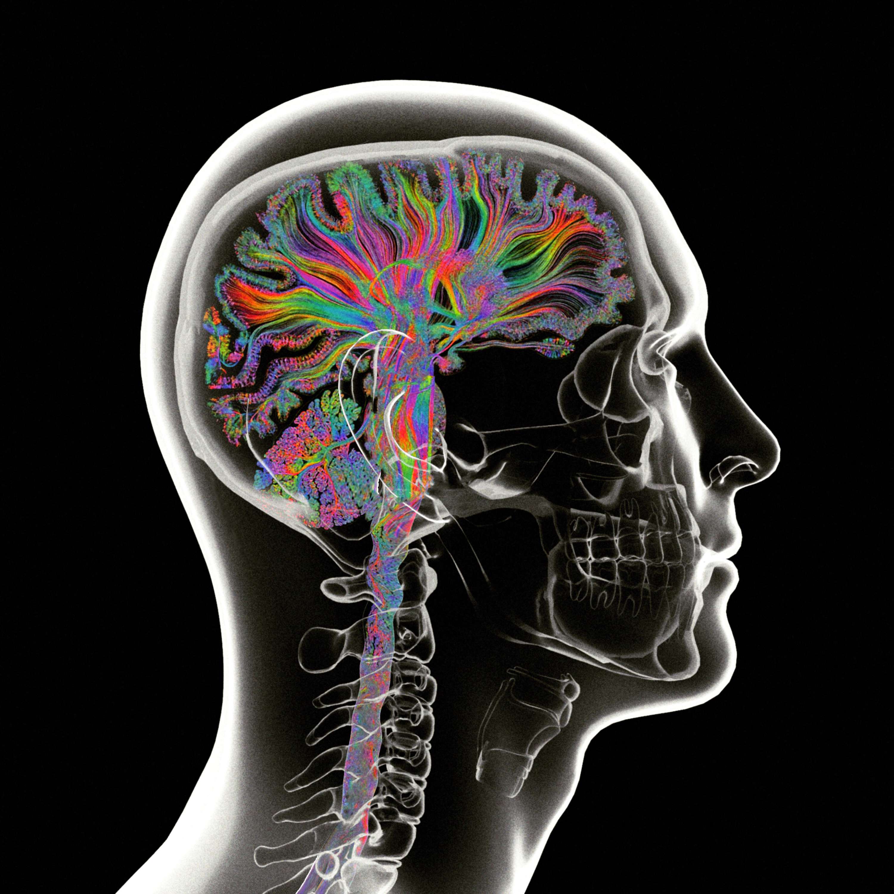 Consciousness by Grégoire A. Meyer