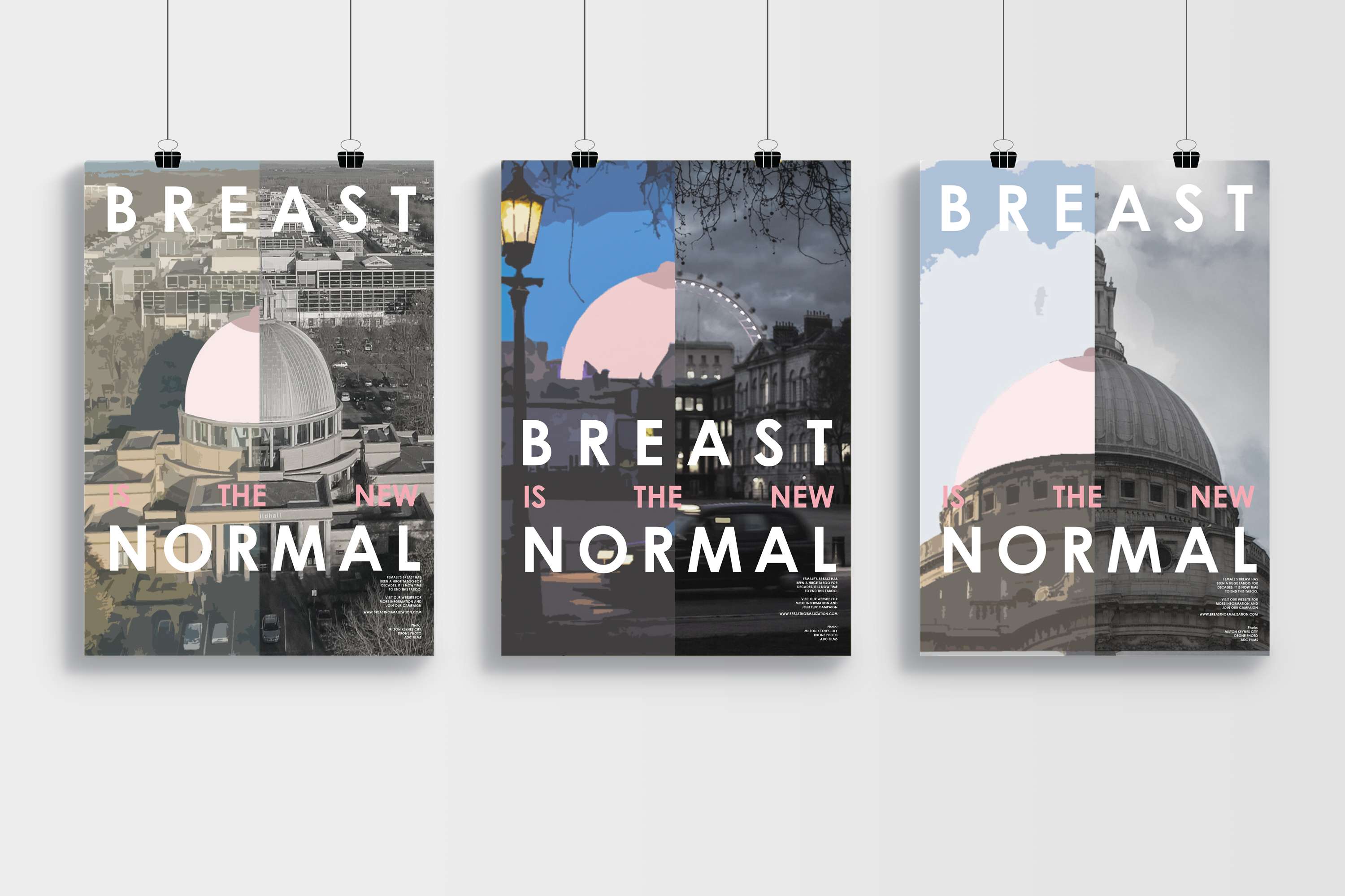 FMP - Breast Normalization by Parnaz Homayouni