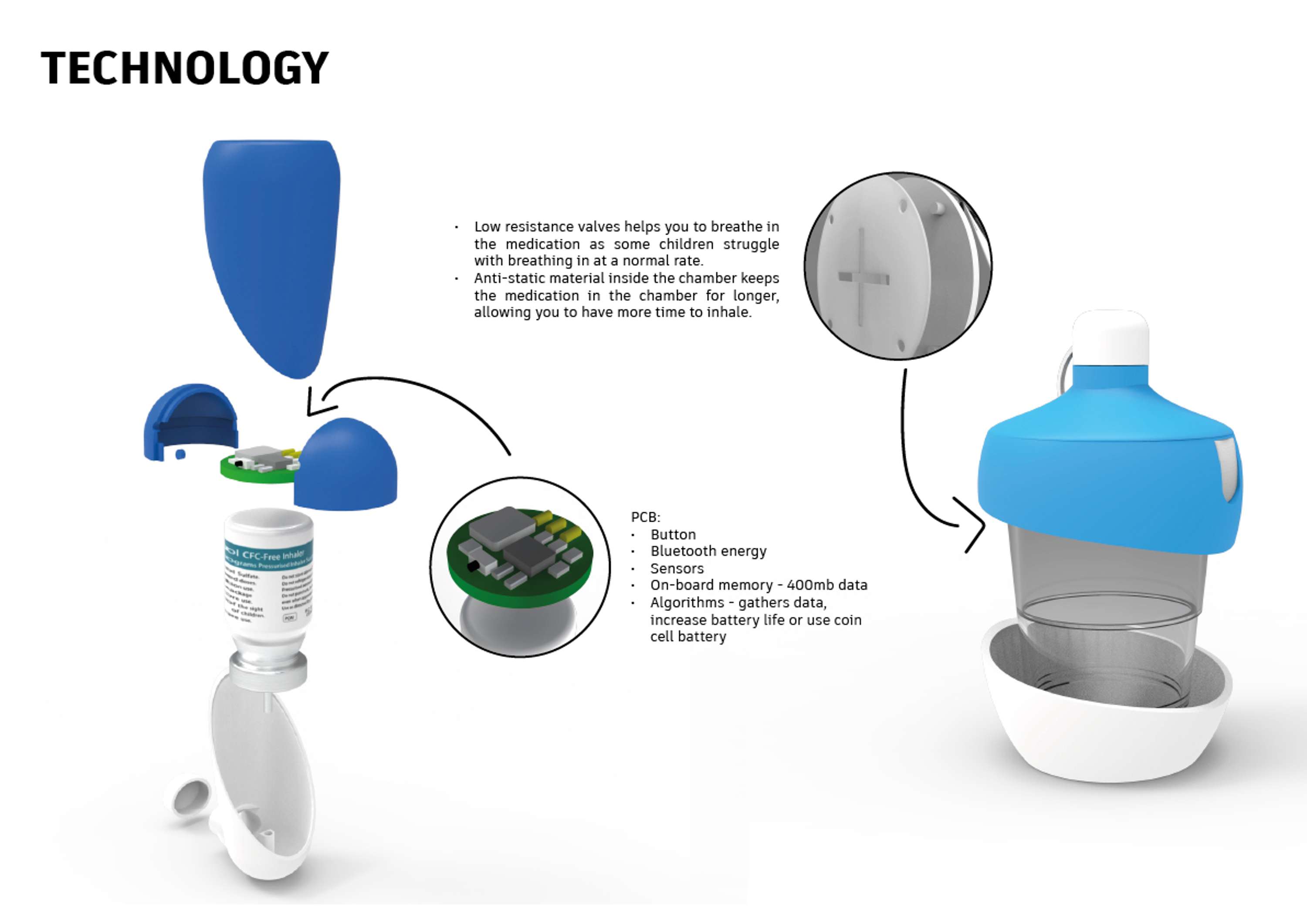 Asthma Kit by Irene Indiran