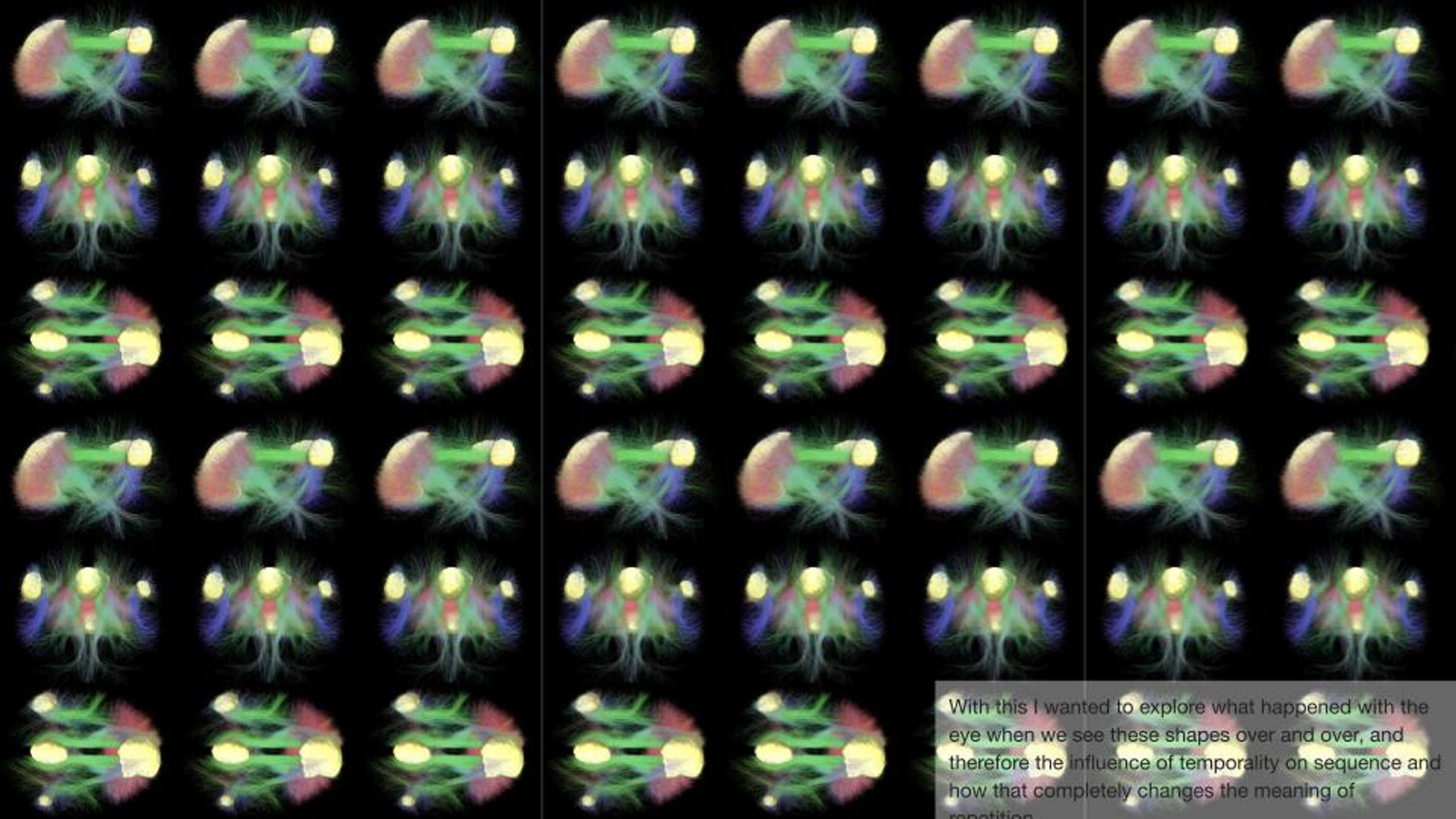 Exploring the Default Mode Network by Hildie Leyser