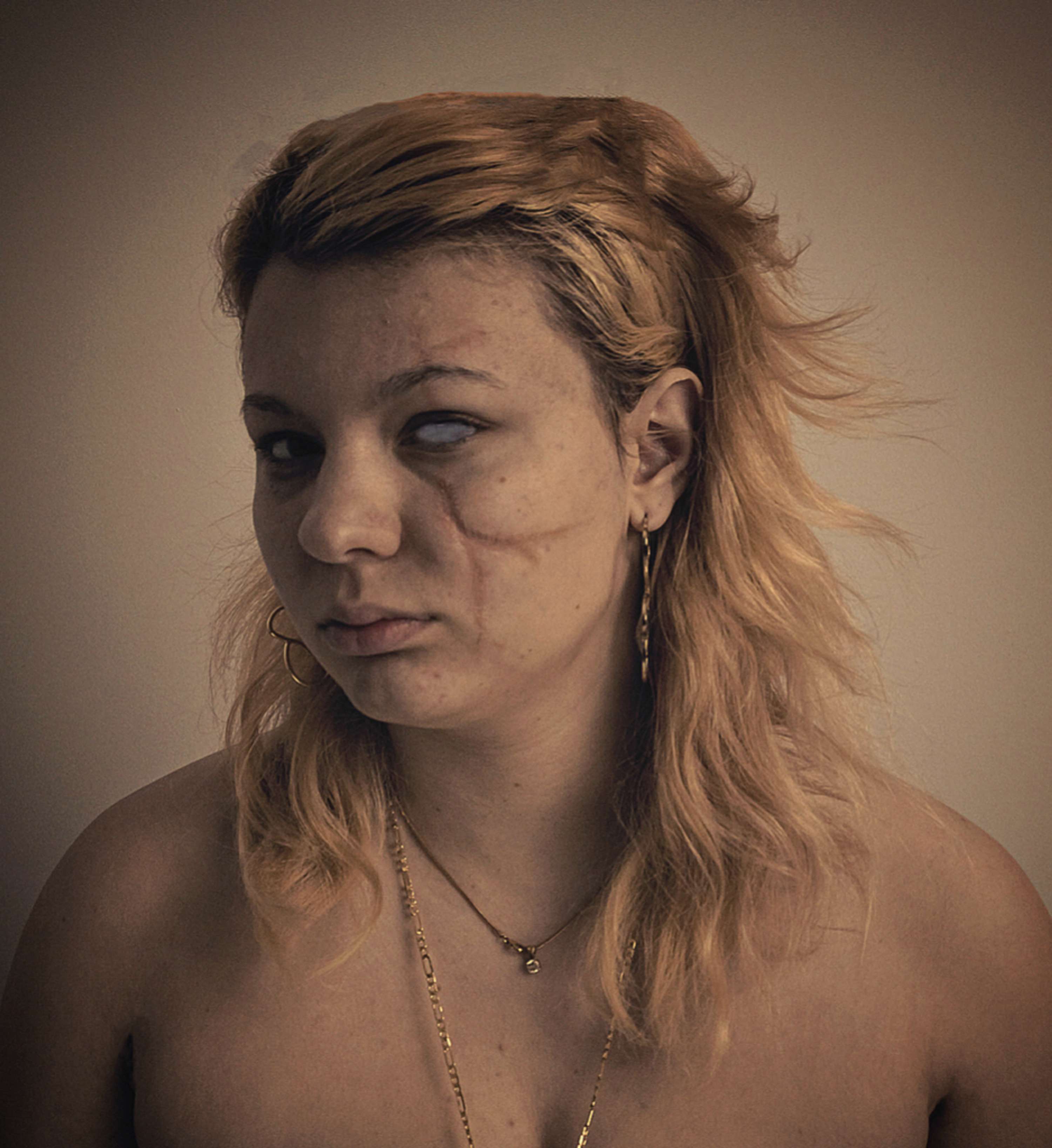 SFX Wounds by Thomas Pitt