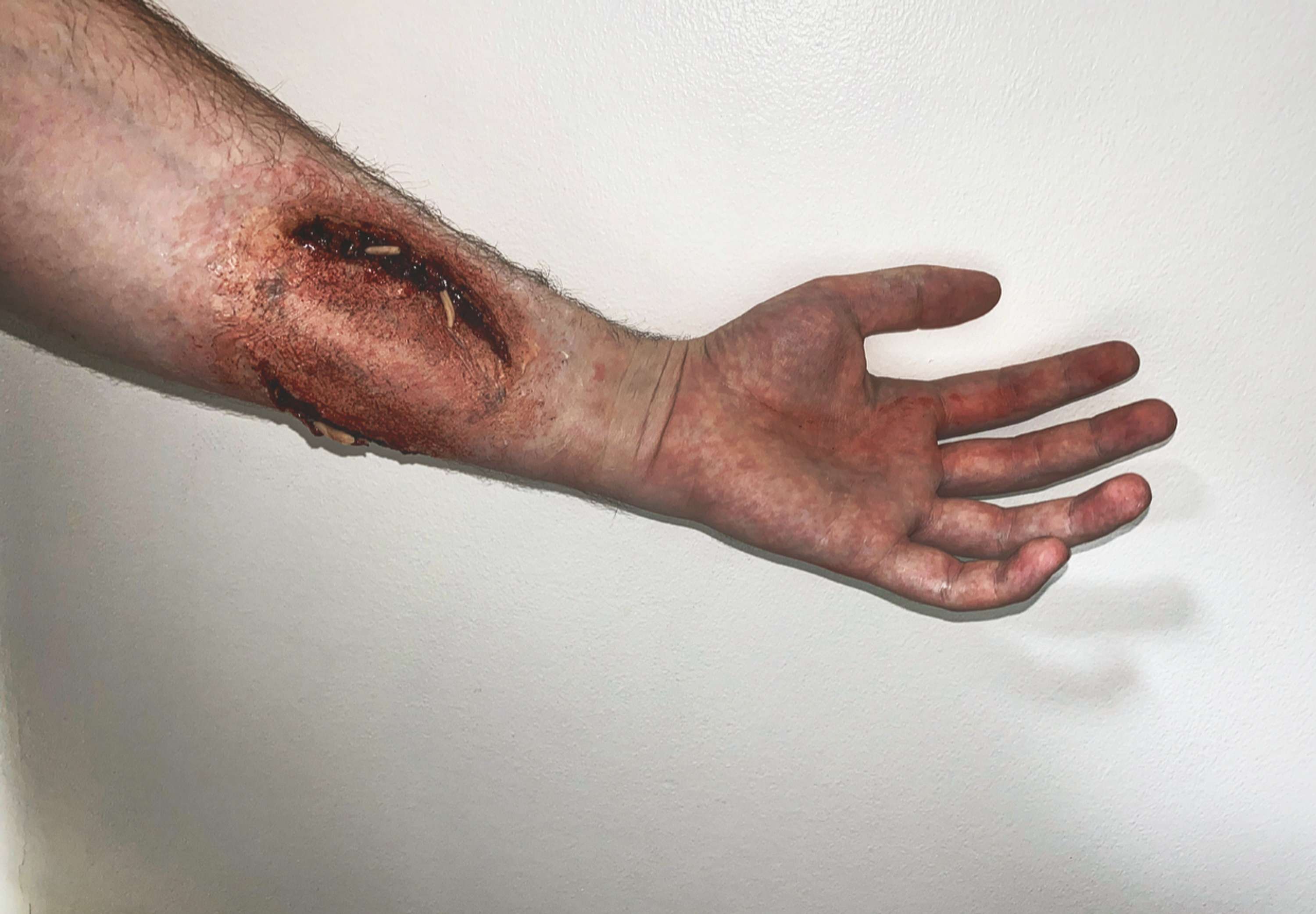 SFX Wounds by Thomas Pitt