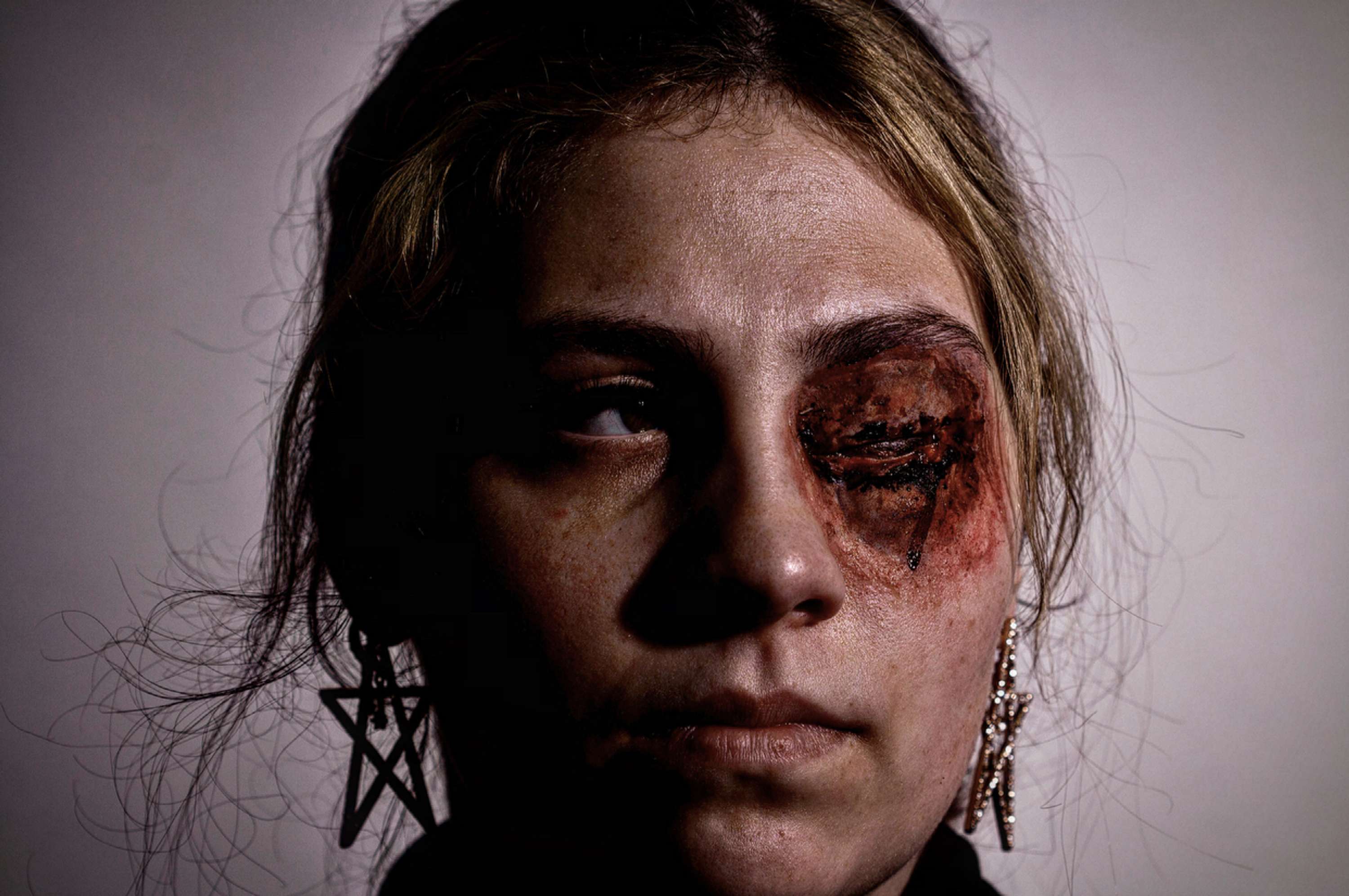 SFX Wounds by Thomas Pitt