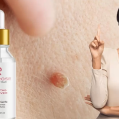 amaroseskintag remover