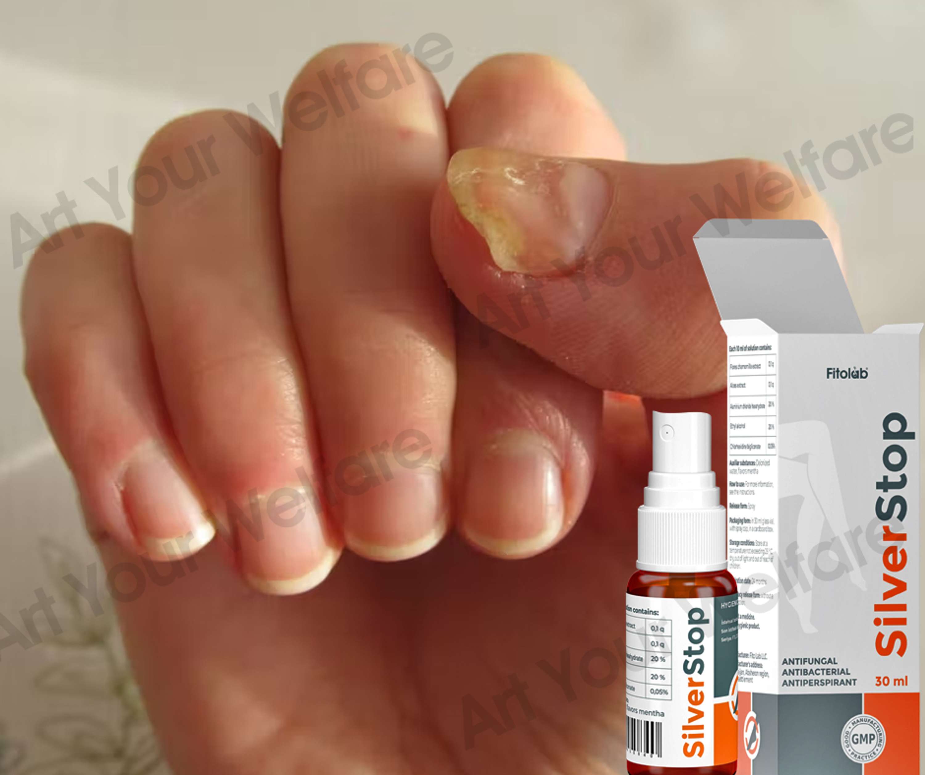 Silverstop Eleştiri - Mantar önleyici sprey by health wellwisher