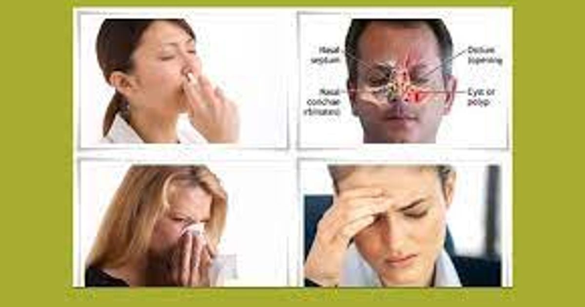 Nasal Polyps Treatment Miracle Reviews Does It Work The Dots