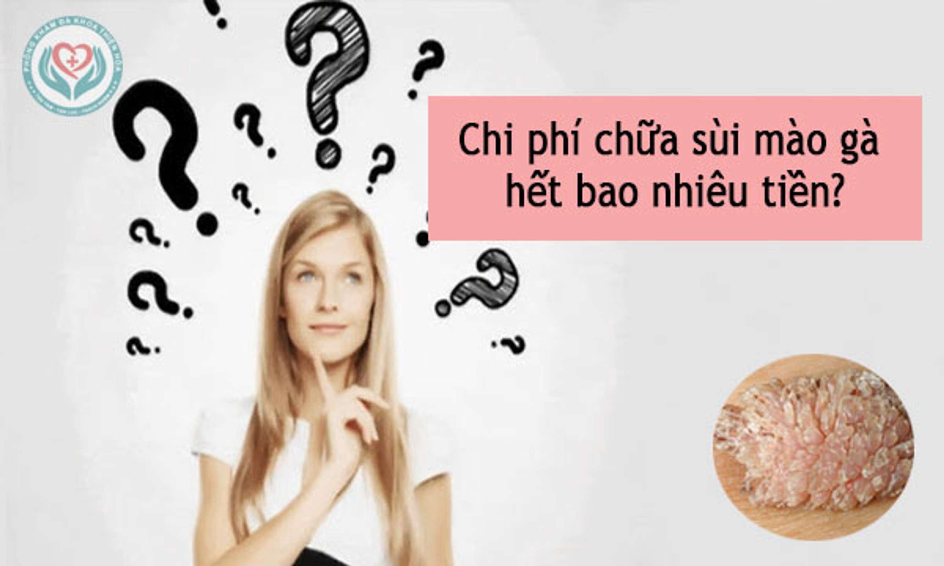 Chi phí chữa sùi mào gà hết bao nhiêu tiền? by Phòng Hòa