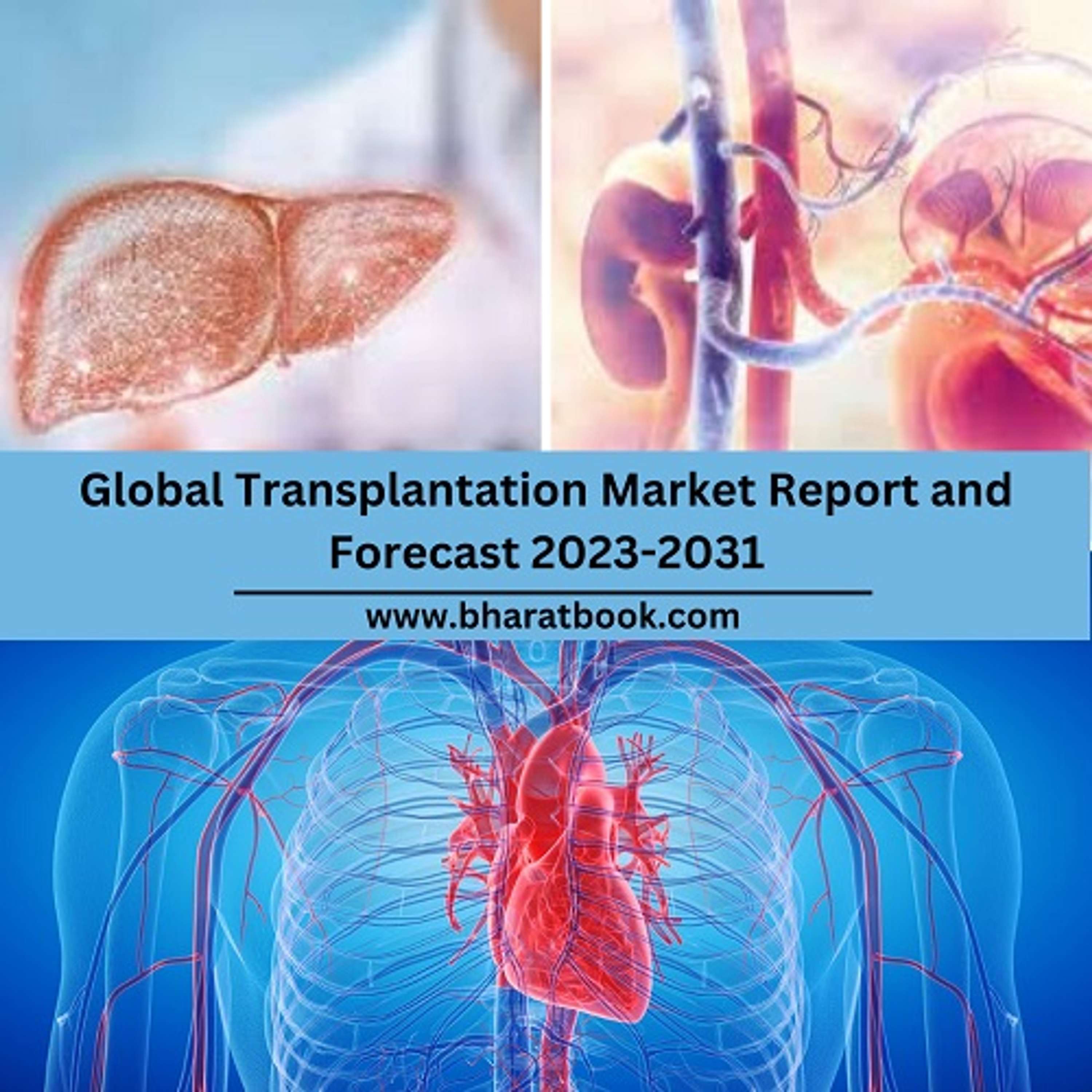 Global Transplantation Market Size Study, By Type, Application, And Regional Forecasts 2023-2031 by Kartik Pilla