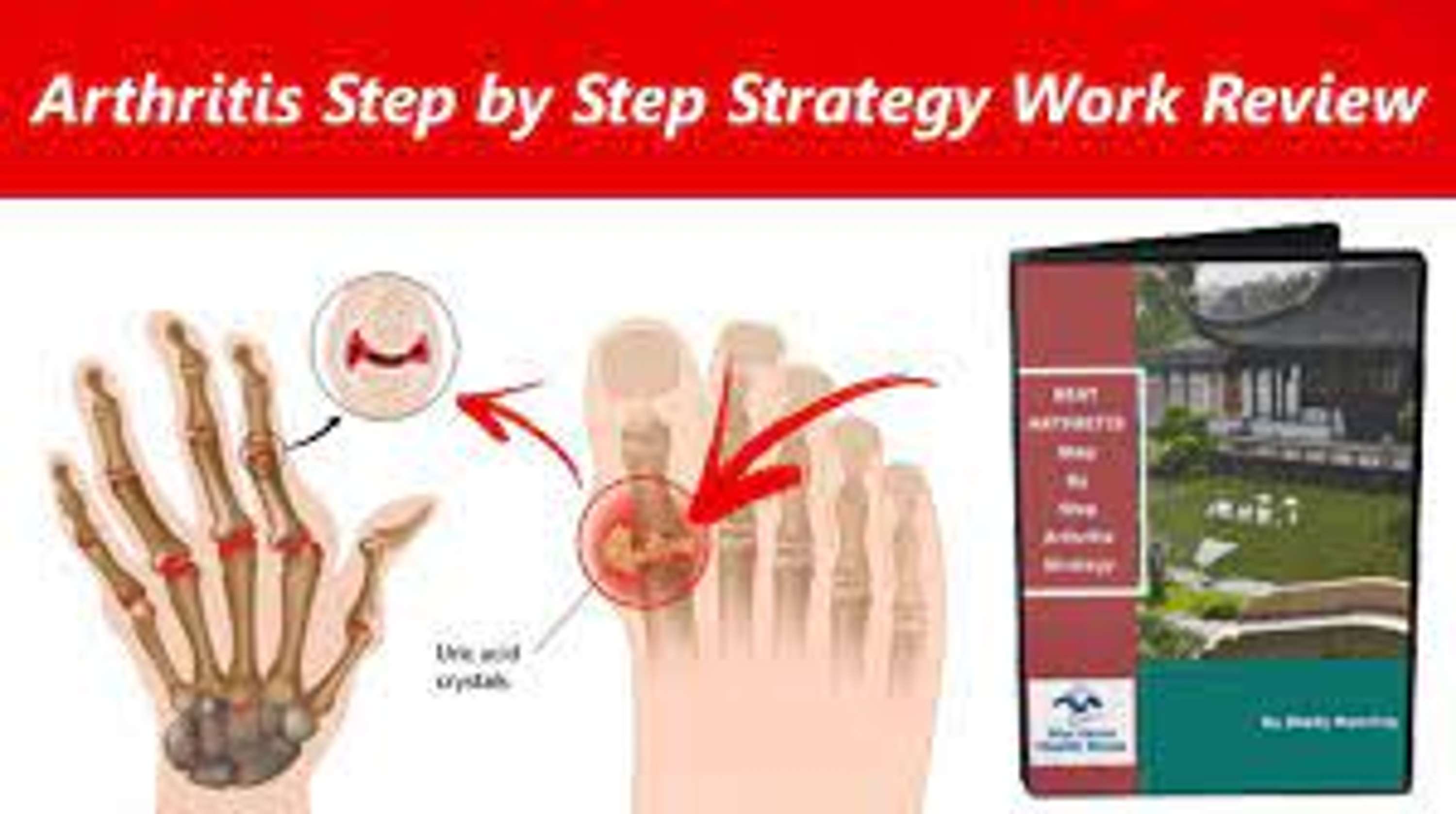 The Arthritis Step By Step Strategy Reviews - By Shelly Manning - PDF BOOK PROGRAM DOWNLOAD by erawer awlove