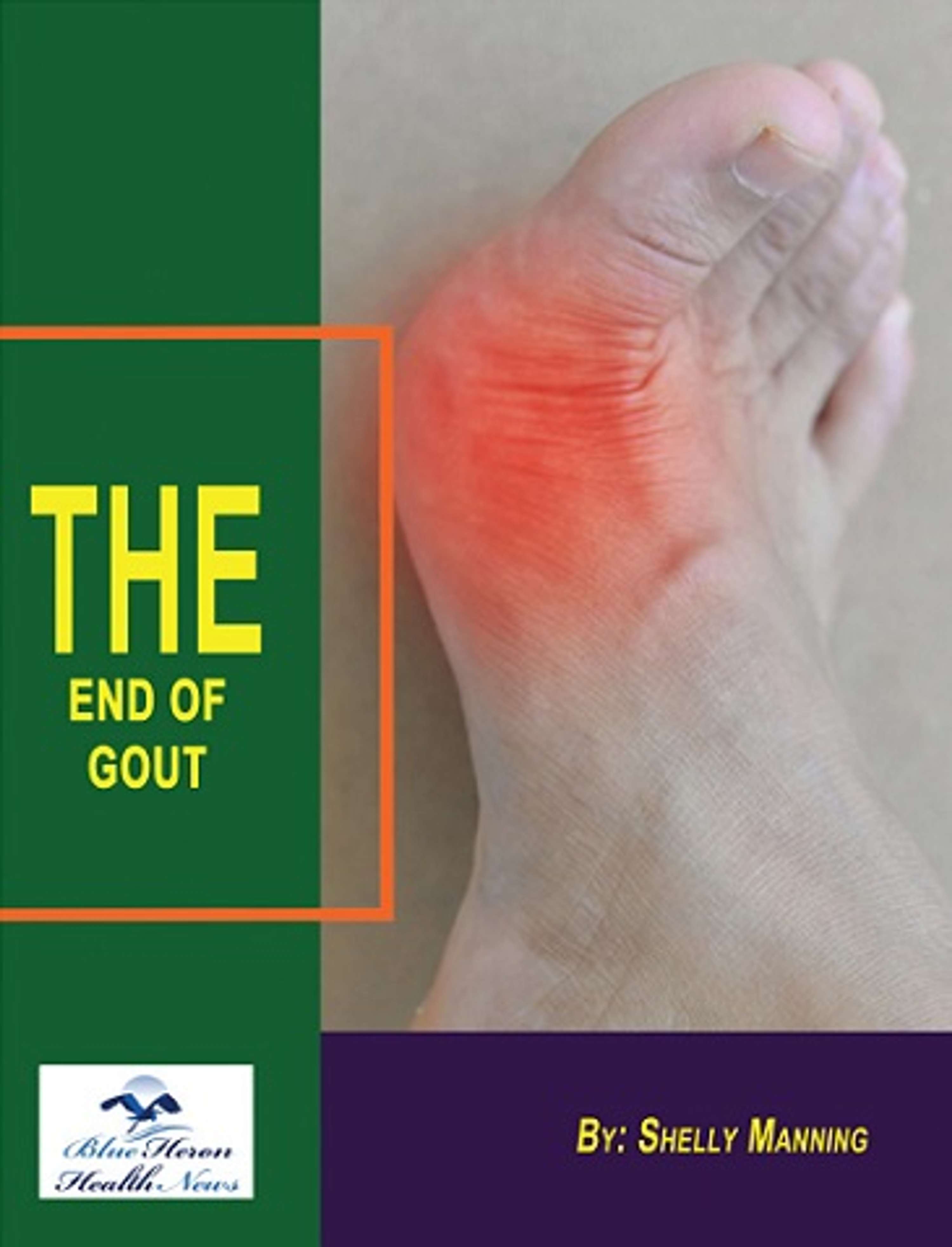 The End Of Gout PDF Book & Diet By Shelly Manning by erawer awlove