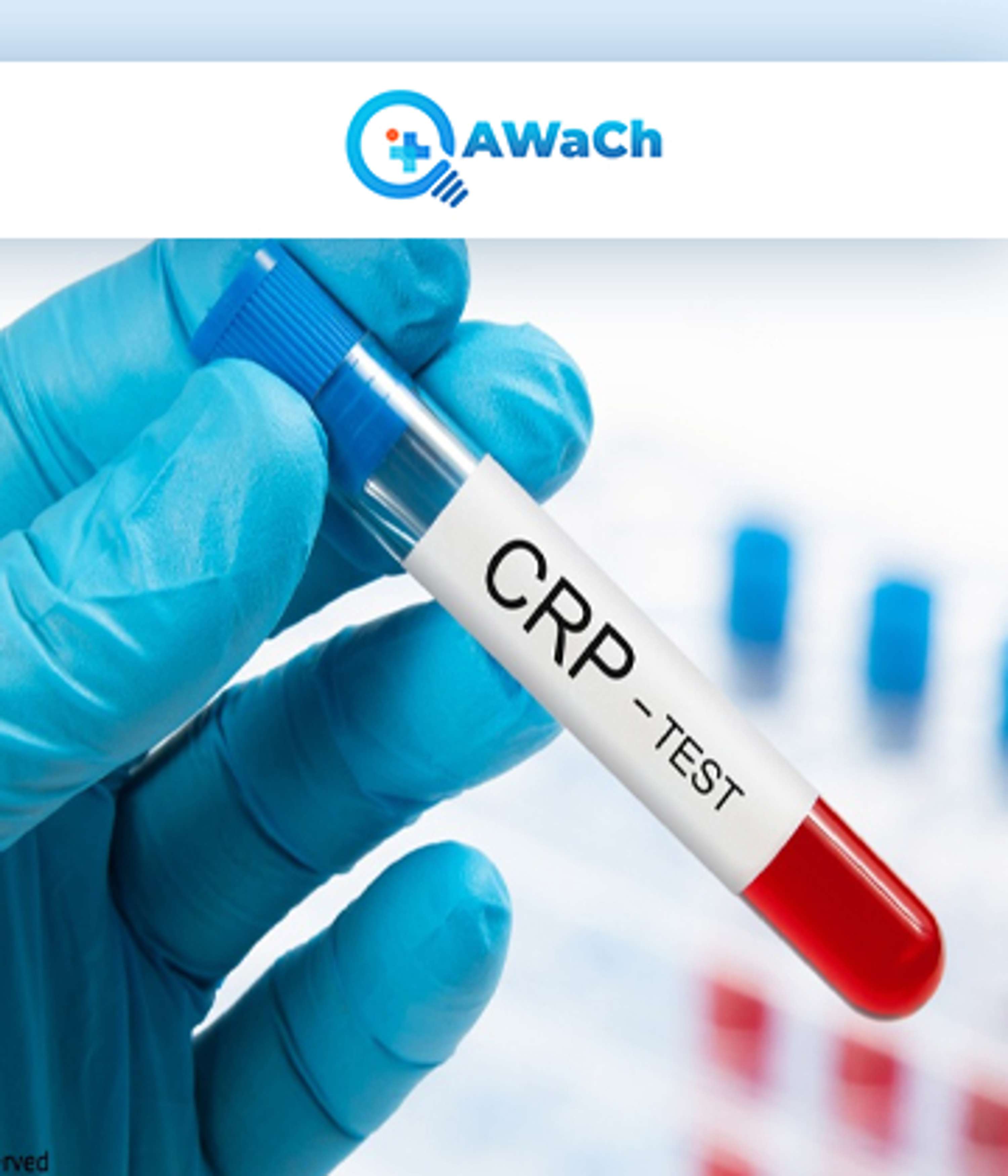 CRP Test by Qawach Bio