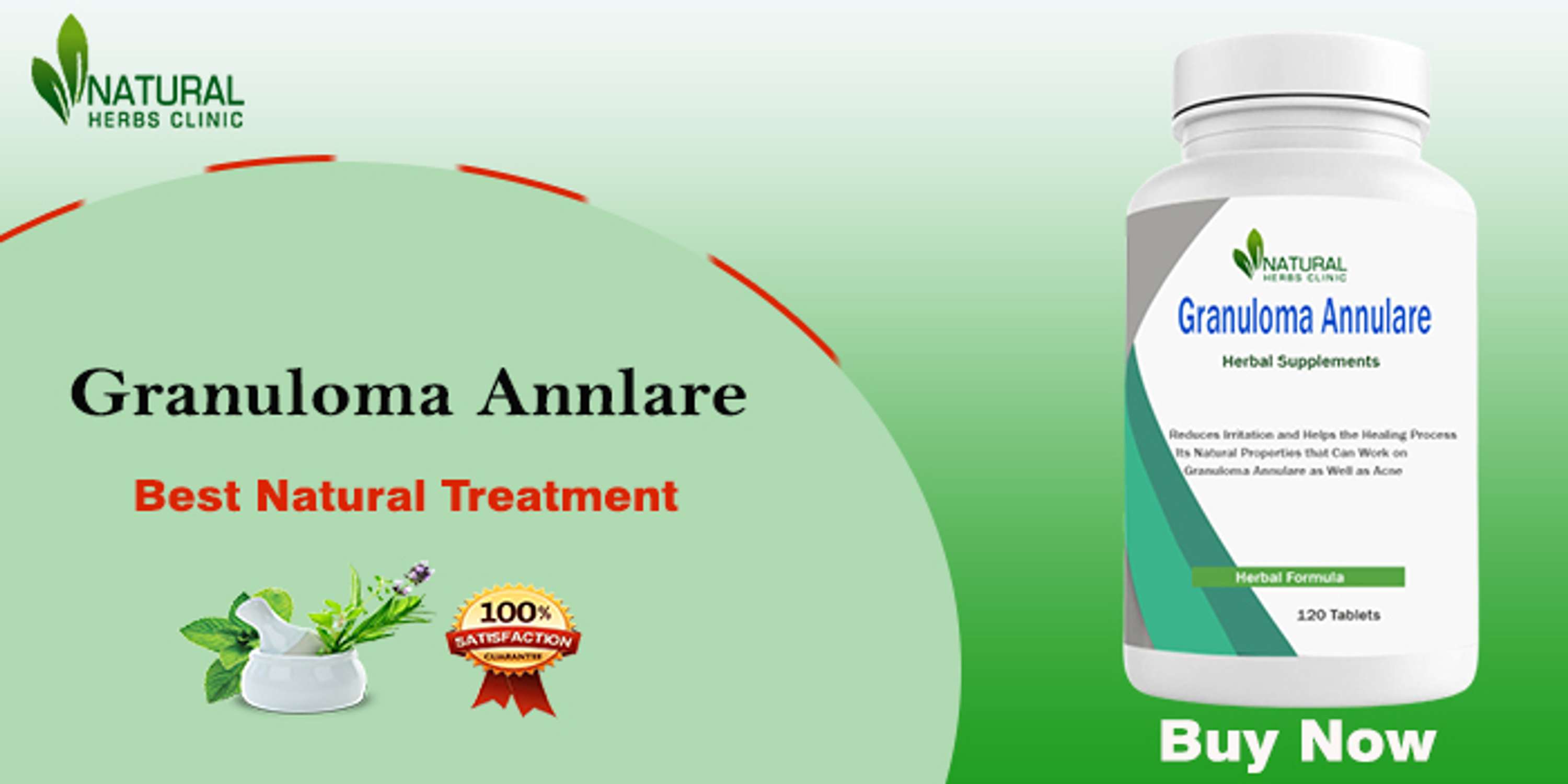 Finding Effective Granuloma Annulare Solutions: Solving the Mystery of Condition by Natural Herbs Clinic