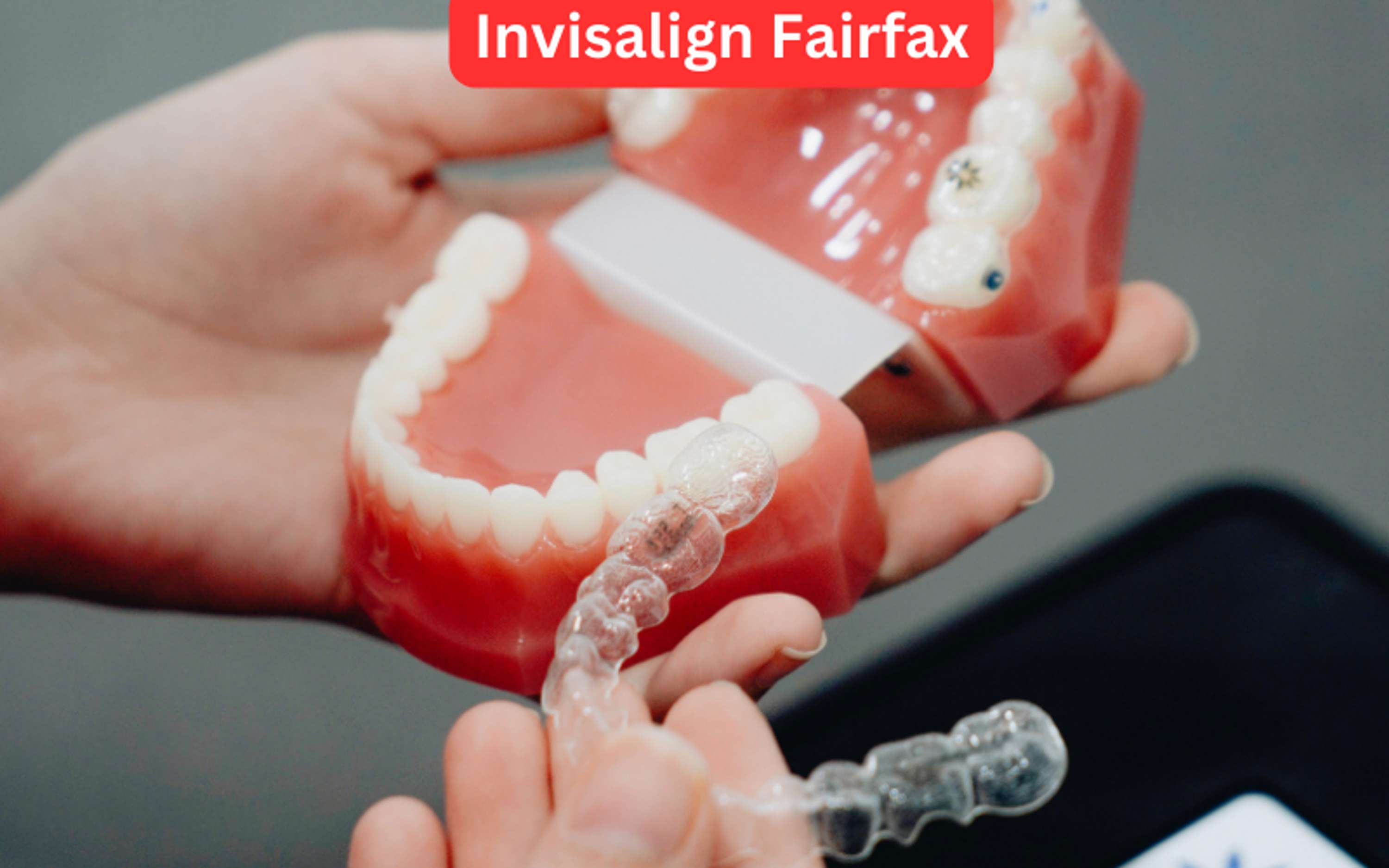Choosing Invisalign Fairfax: A Clear Path to Straight Teeth by Lucas Jones