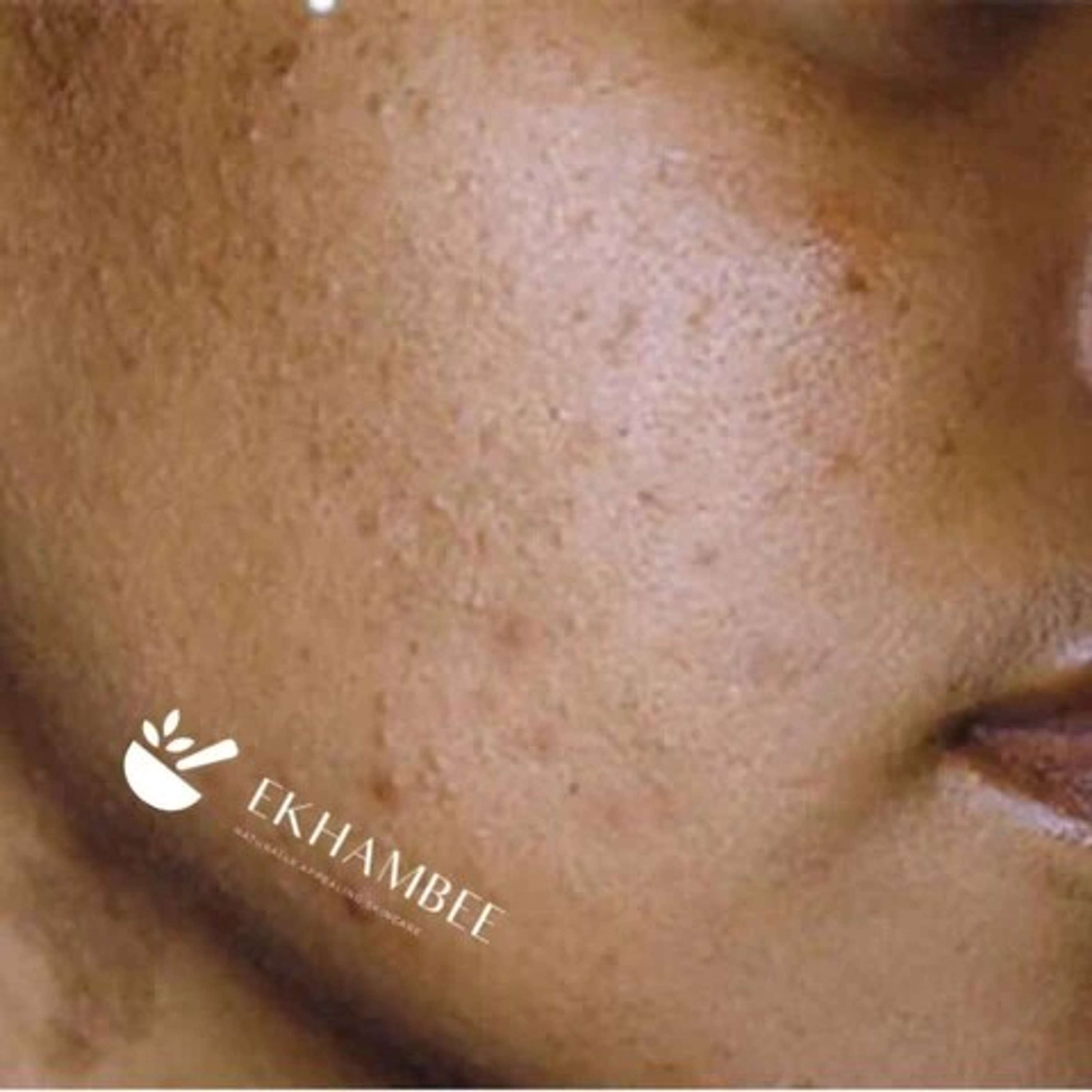 Reasons Behind Small Brown Dots on Skin: Understanding and Solutions by Ekhambee .