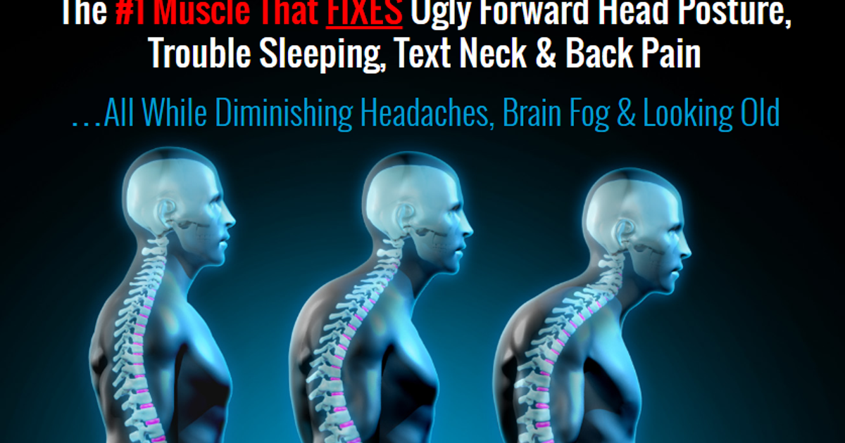 Forward Head Posture Fix The Best Ways To Fix Forward Head Posture Nerd Neck The Dots 