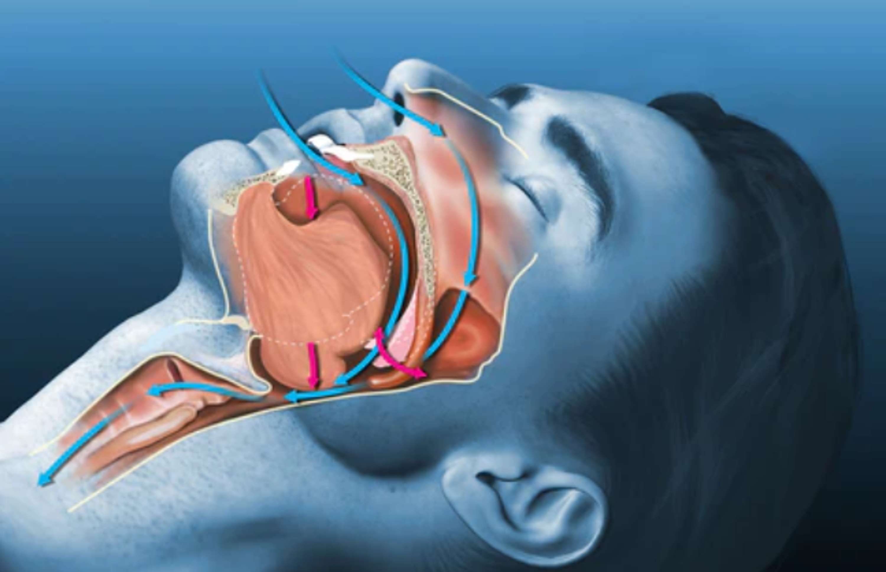 The Stop Snoring Exercise Program: A Proven Way to Get a Good Night’s Sleep by Christian Goodman