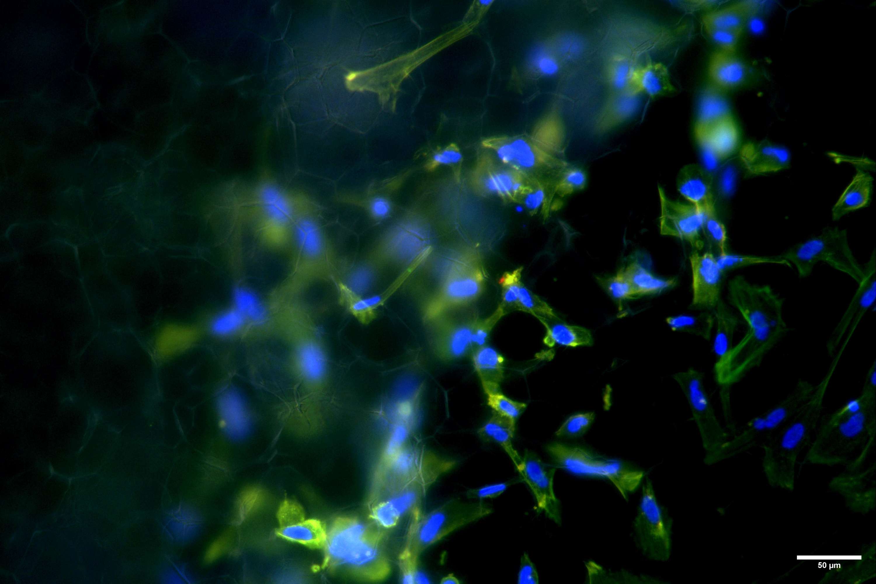 Investigating the Effect of Tissue Engineering   Scaffold Architecture on Cell Morphogenesis by Bharat Jassal