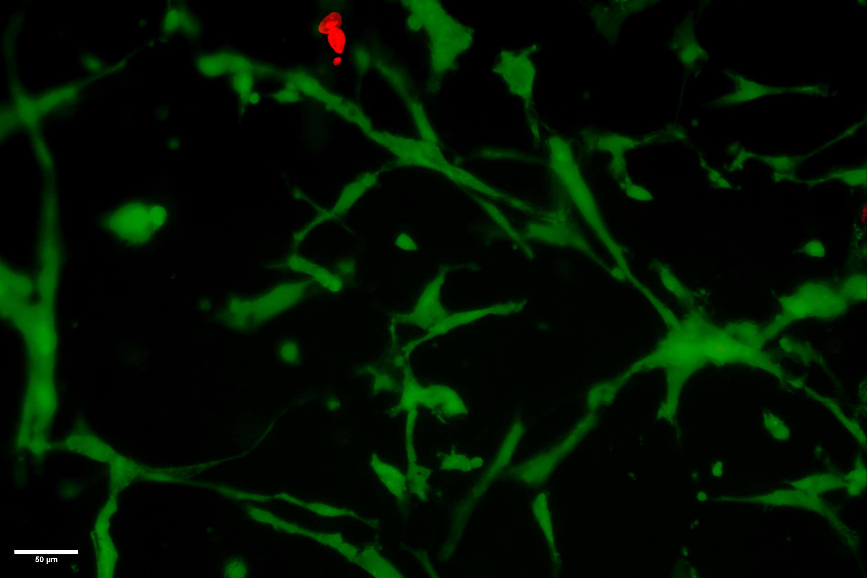 Investigating the Effect of Tissue Engineering   Scaffold Architecture on Cell Morphogenesis by Bharat Jassal