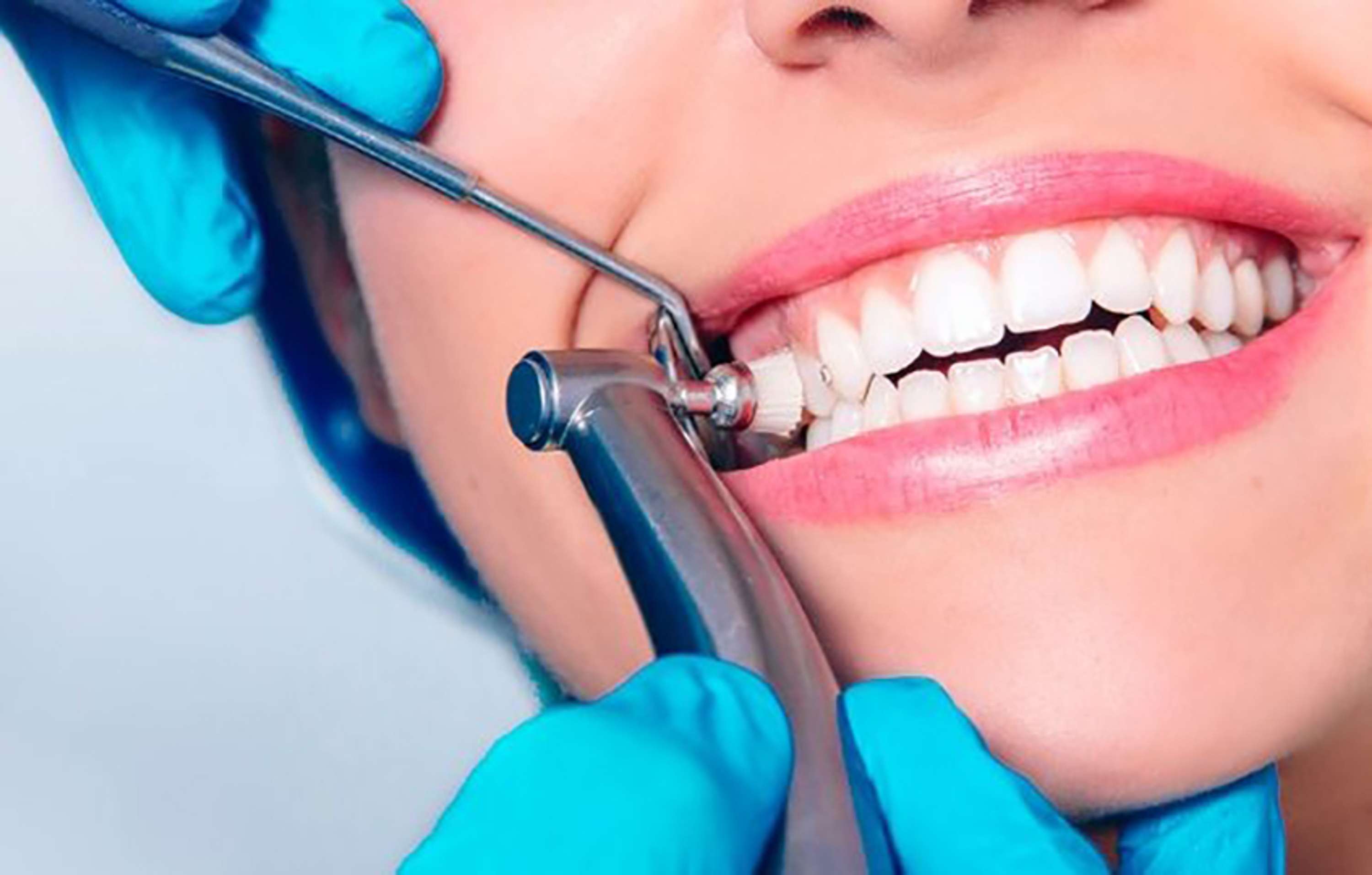 What Is a Root Canal and Why Is It Necessary? by Digital Tooth Fairy