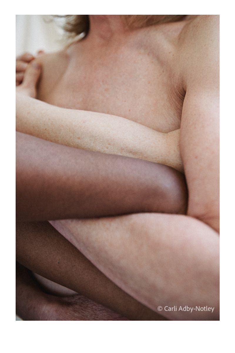 SKIN by Carli Adby-Notley