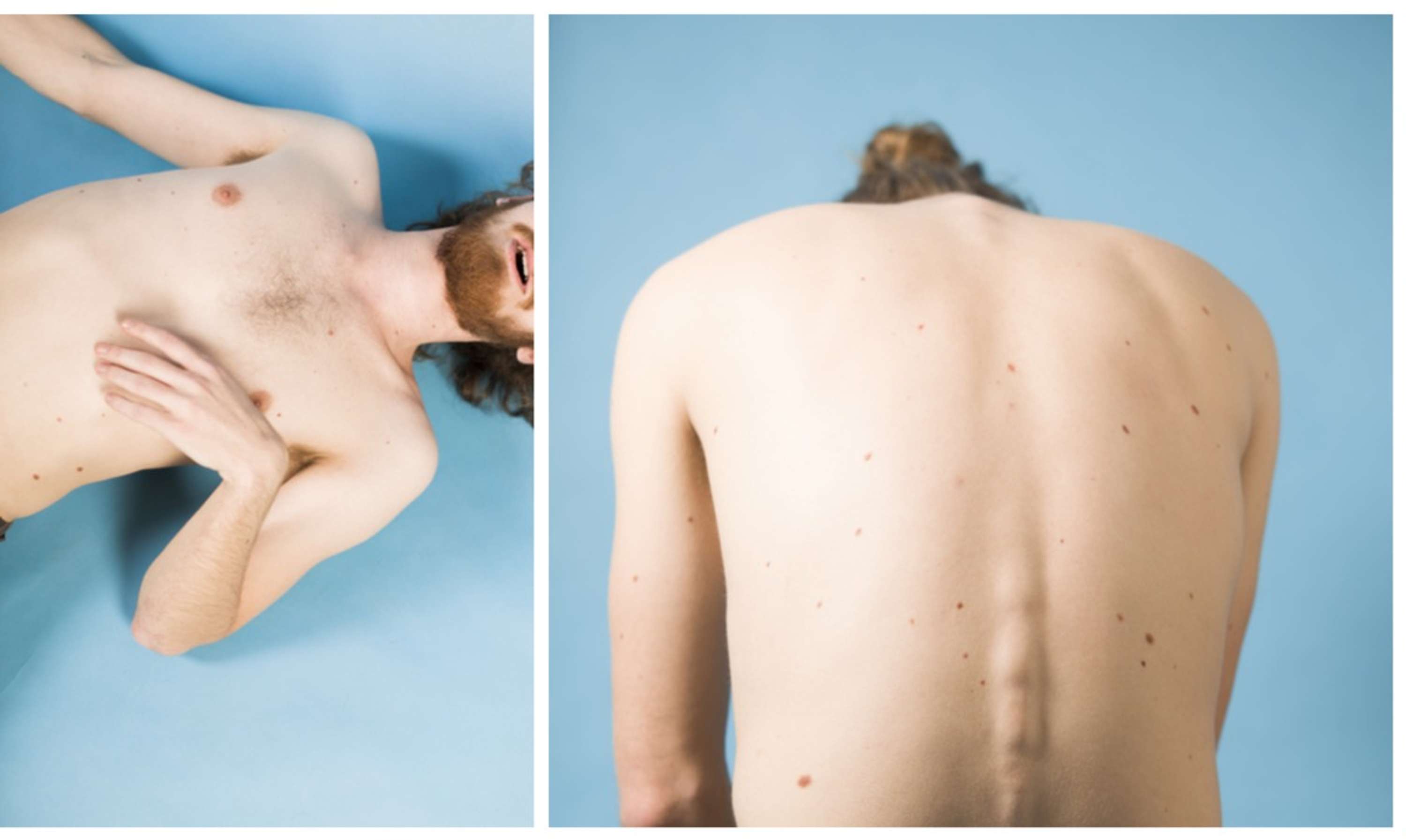 Project: Some(Body) by Anna Červinková